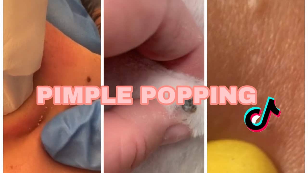 10 MINUTES OF PIMPLE POPPING✨✨
