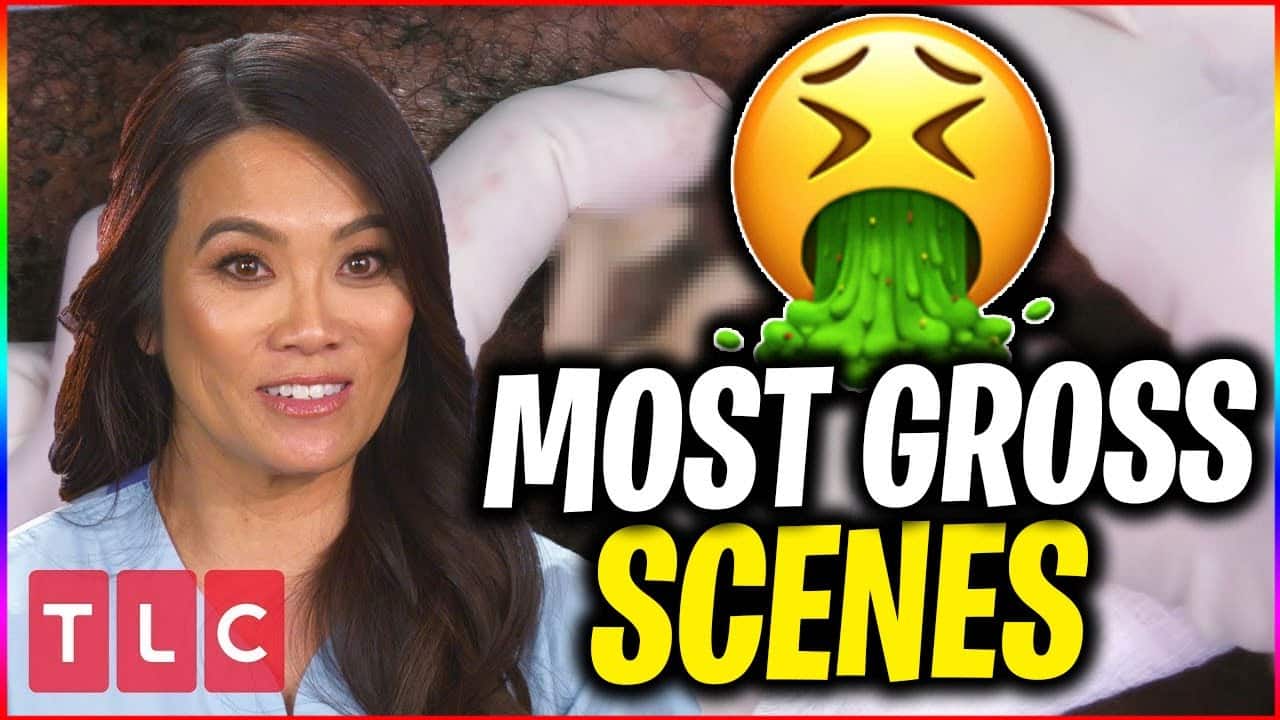 10 of the GROSSEST Dr Pimple Popper Scenes in History