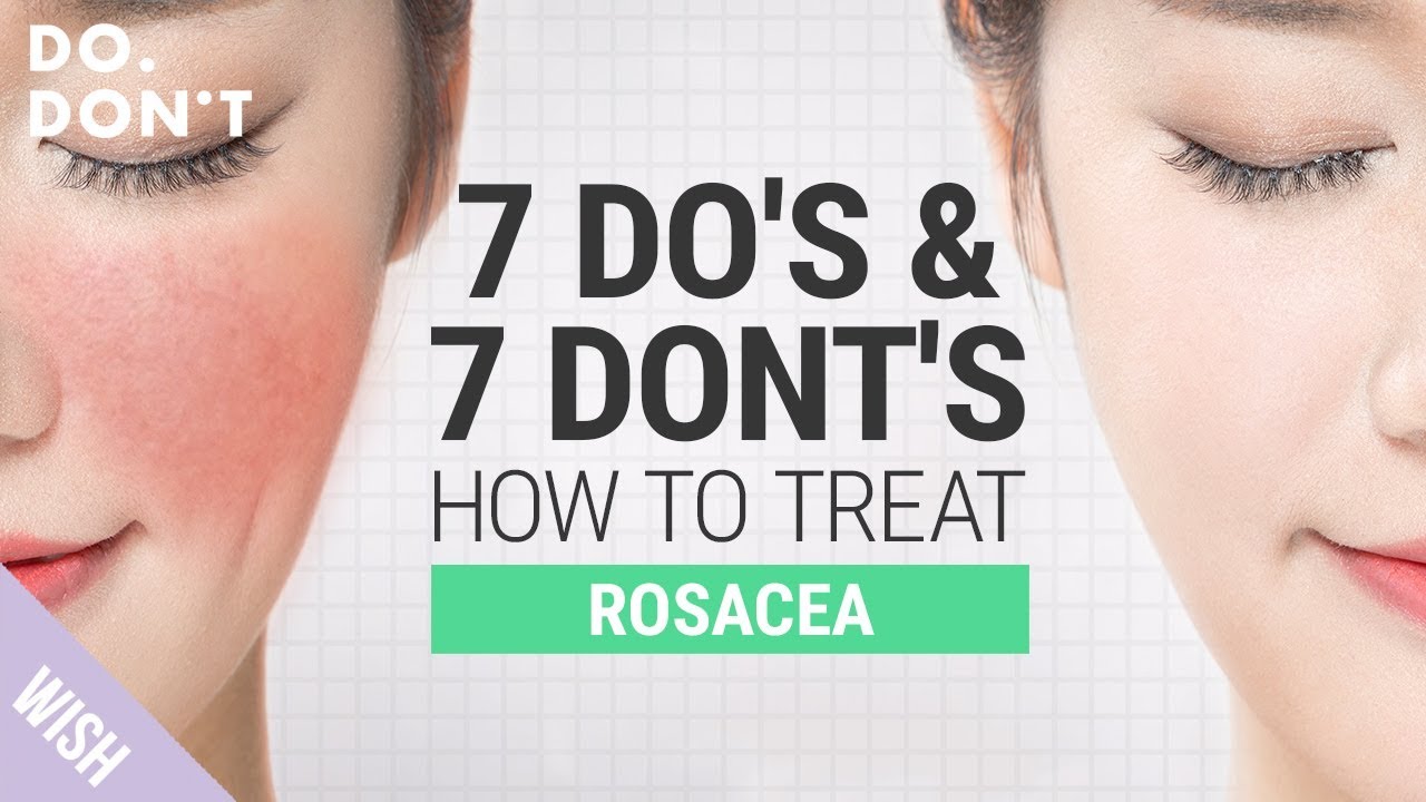 14 Tips for Rosacea That Really Work | Effective Skin Care Tips for Rosacea | Do & Don't