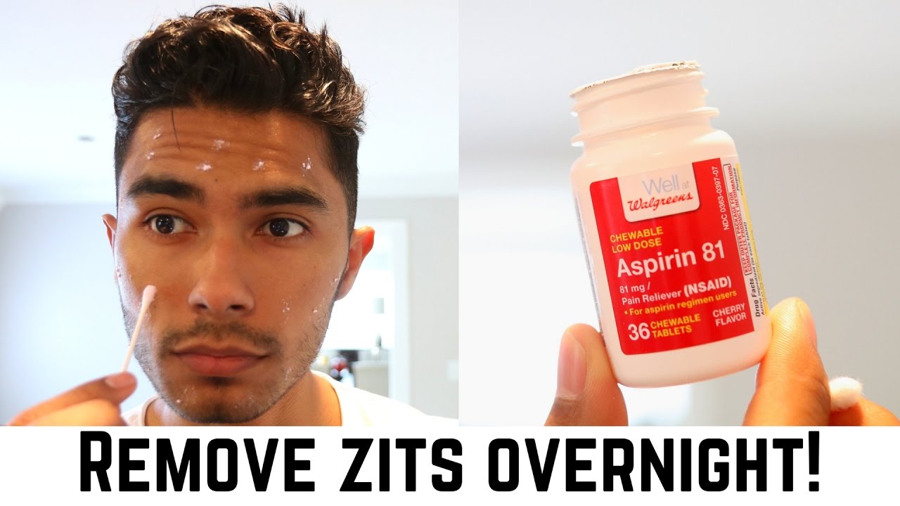 3 At-Home Hacks To Remove Zits Overnight!
