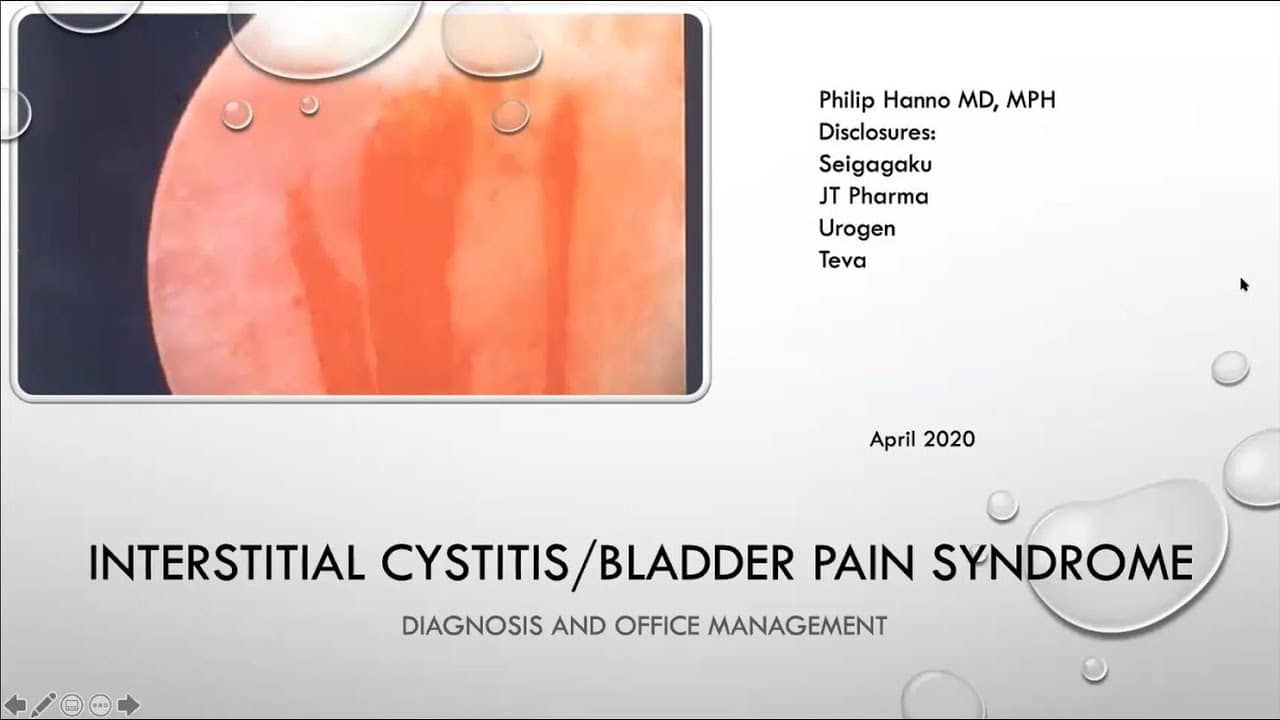 4.13.2020 Urology COViD Didactics – Interstitial Cystitis/Bladder Pain Syndrome (IC/BPS)