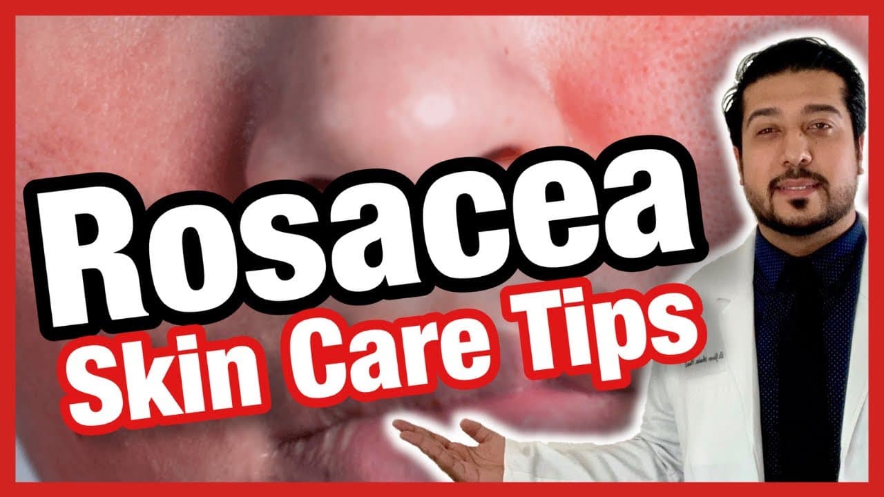 5 Quick Ways to Get Rid of Rosacea FAST | How to Get Rid of Rosacea (2021)