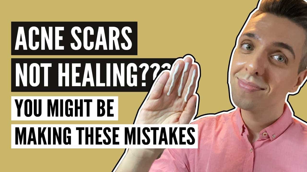 5 Reasons Your Acne Scars Aren’t Healing | FOR SCARS THAT JUST WON’T GO AWAY