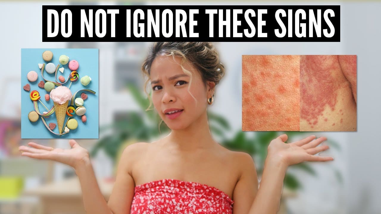 7 Signs You Have Fungal Acne! (With Pictures)