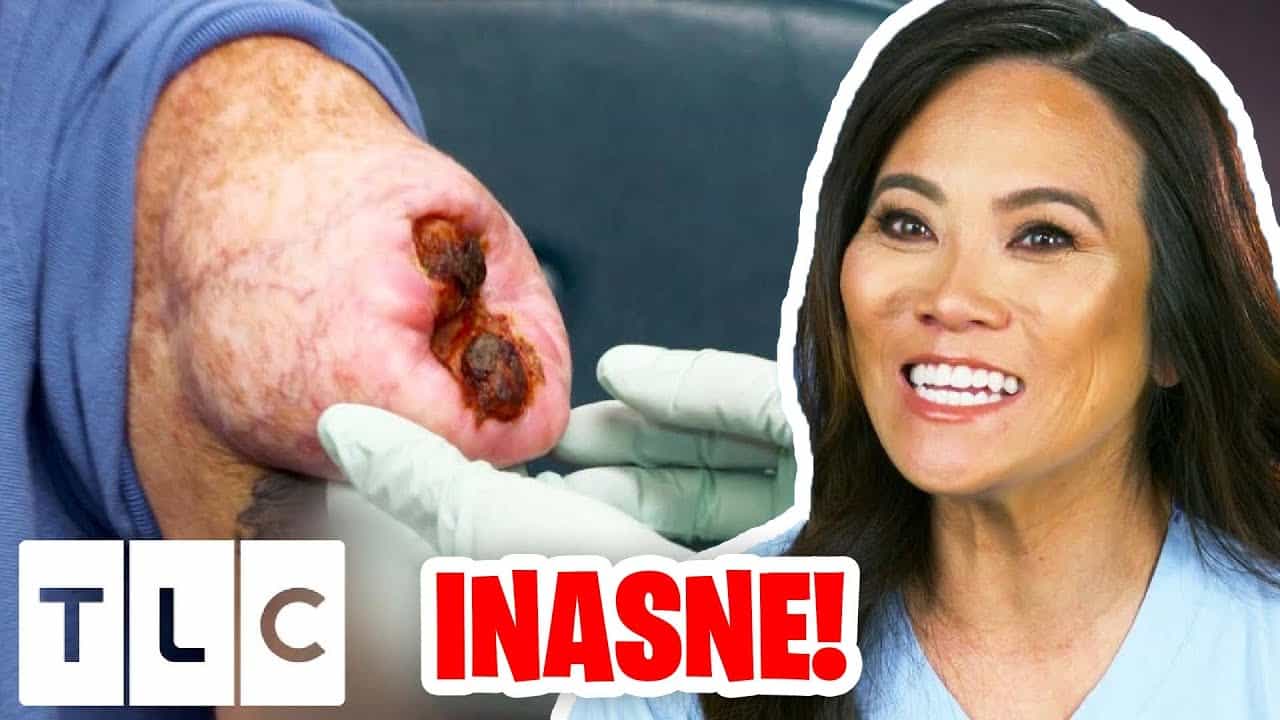 8 of the MOST INSANE moments on Dr. Pimple Popper! (Part 26)