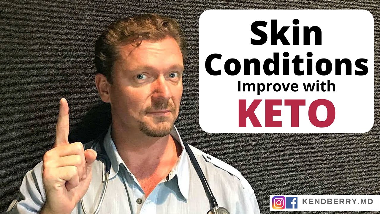 9 Skin Conditions Improved with KETO – 2021 (Acne, Eczema, Psoriasis…)