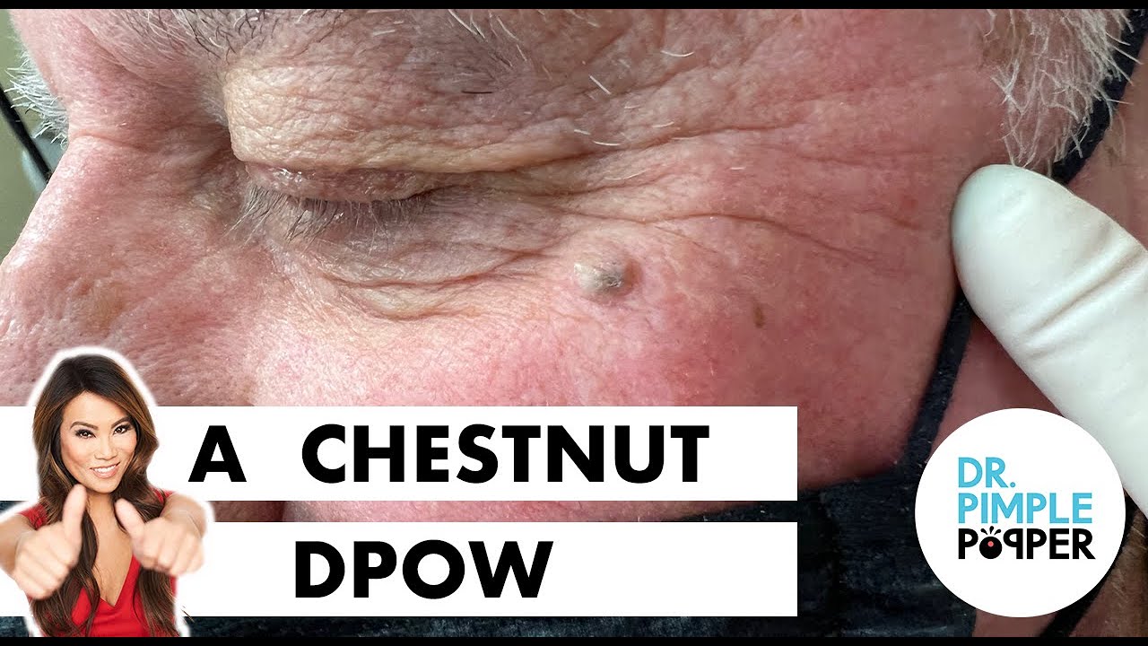 A Chestnut DPOW