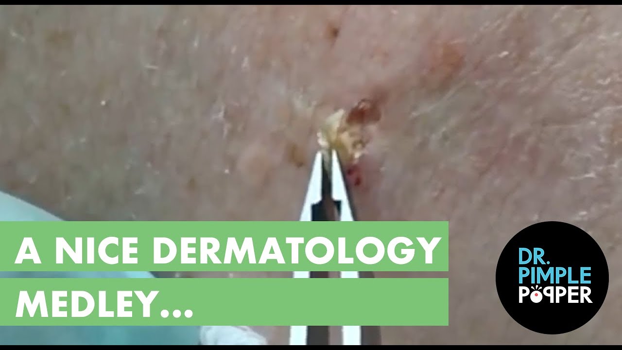 A nice Dermatology Medley