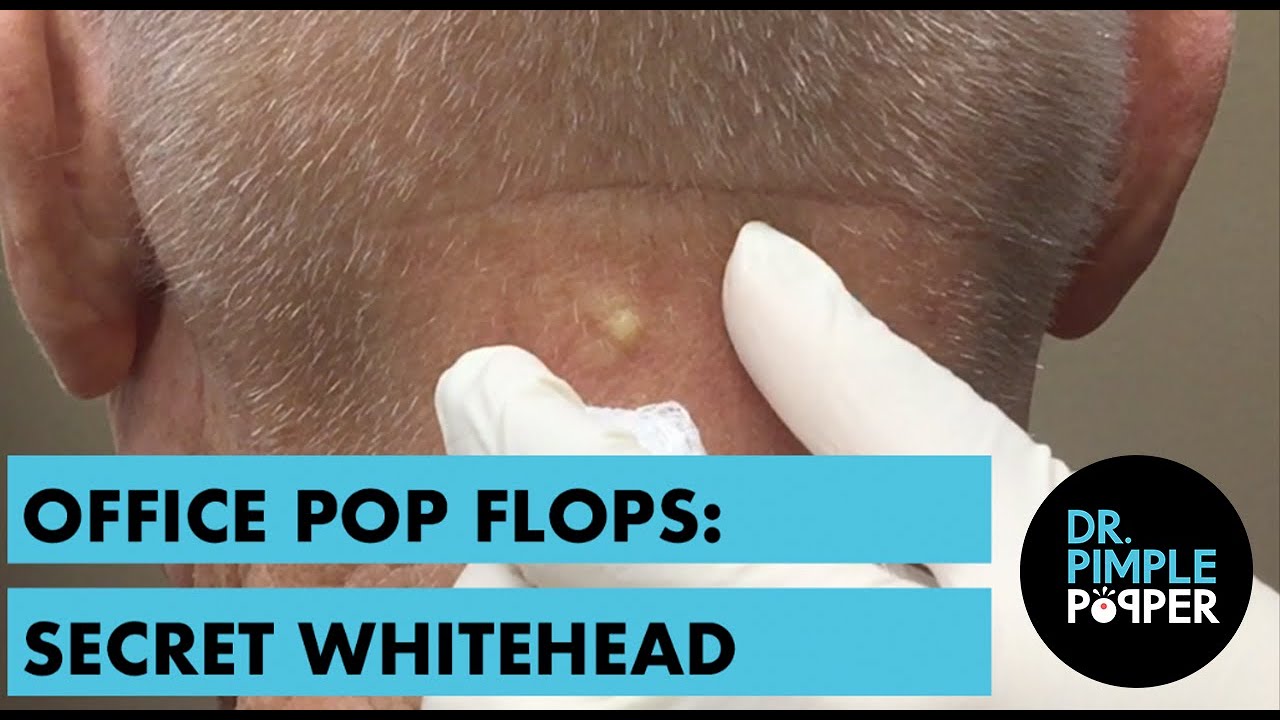 A Nice Whitehead on the Neck: OFFICE POP FLOP