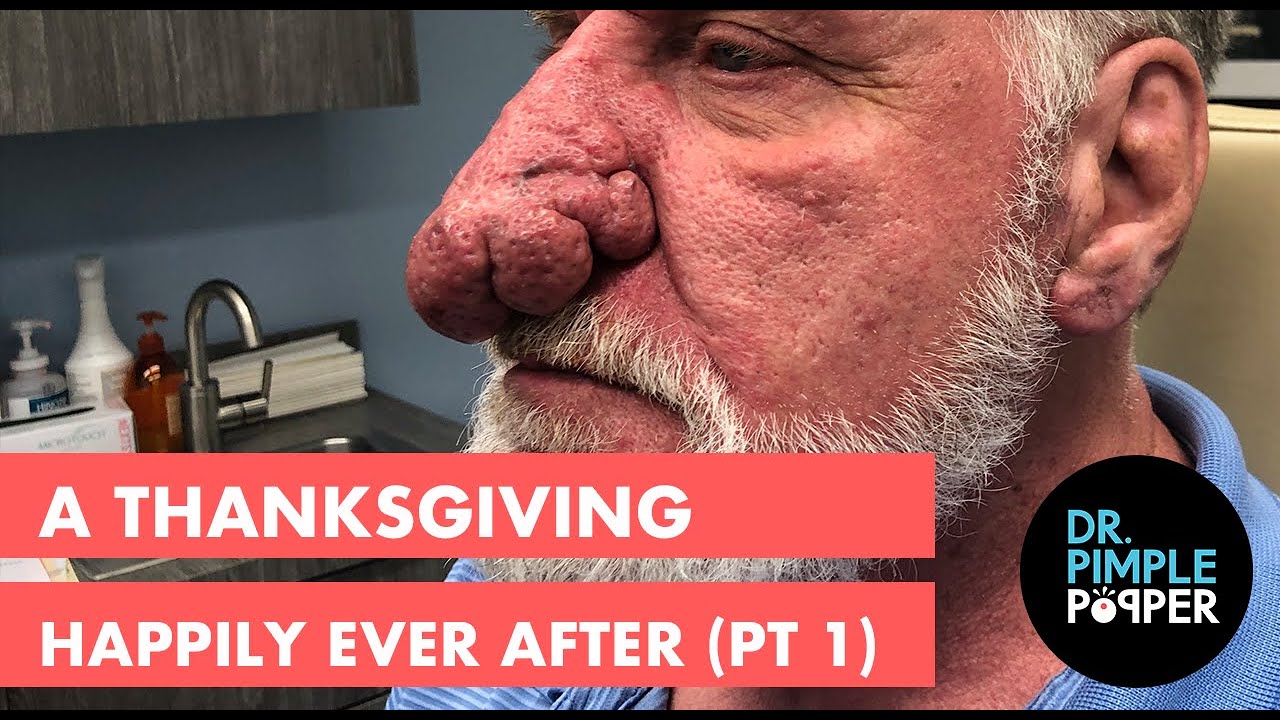 A Thanksgiving Happily Ever After (Part 1)