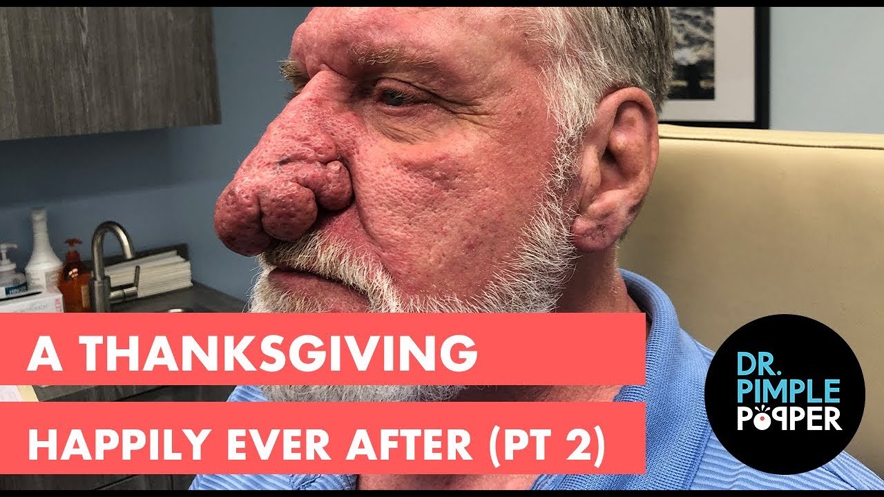 A Thanksgiving Happily Ever After (Part 2)