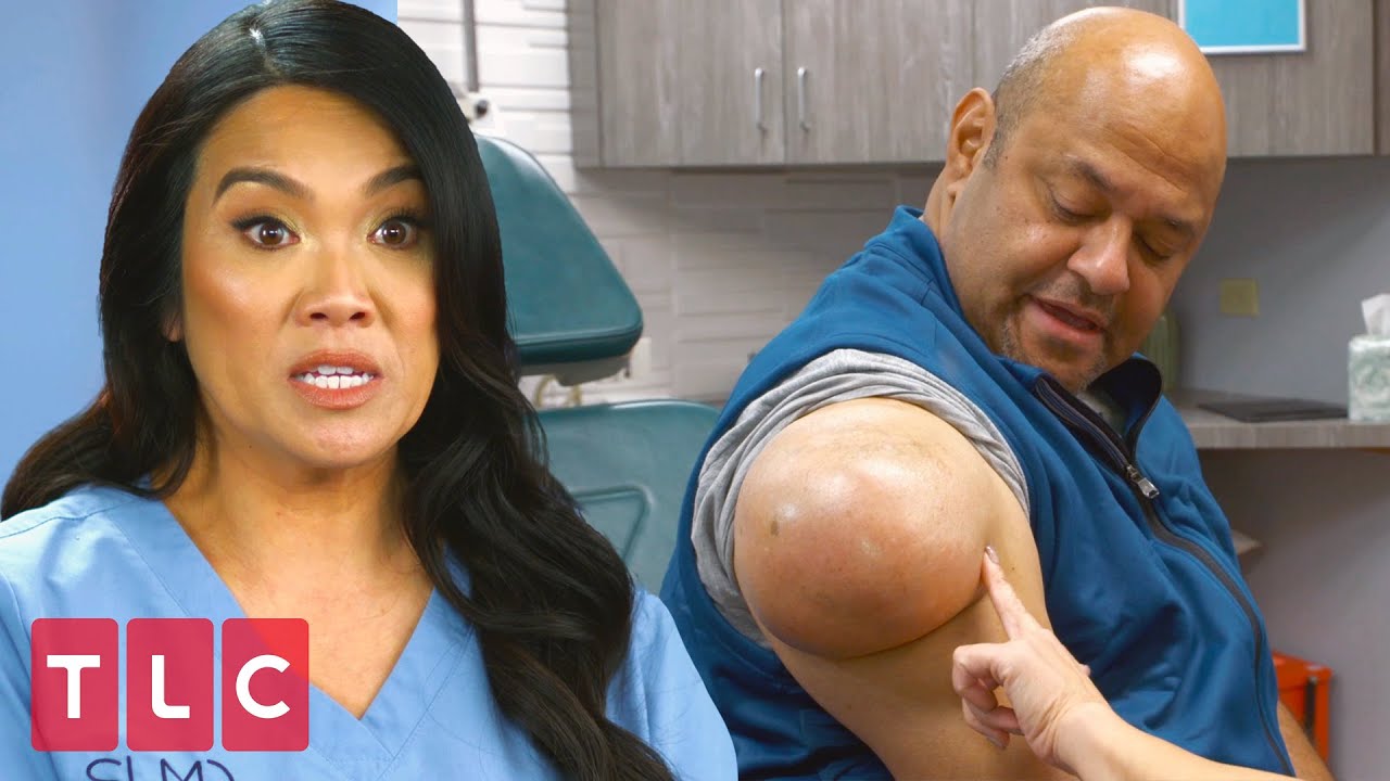 A Weight Off His Shoulder | Dr. Pimple Popper (Extended)