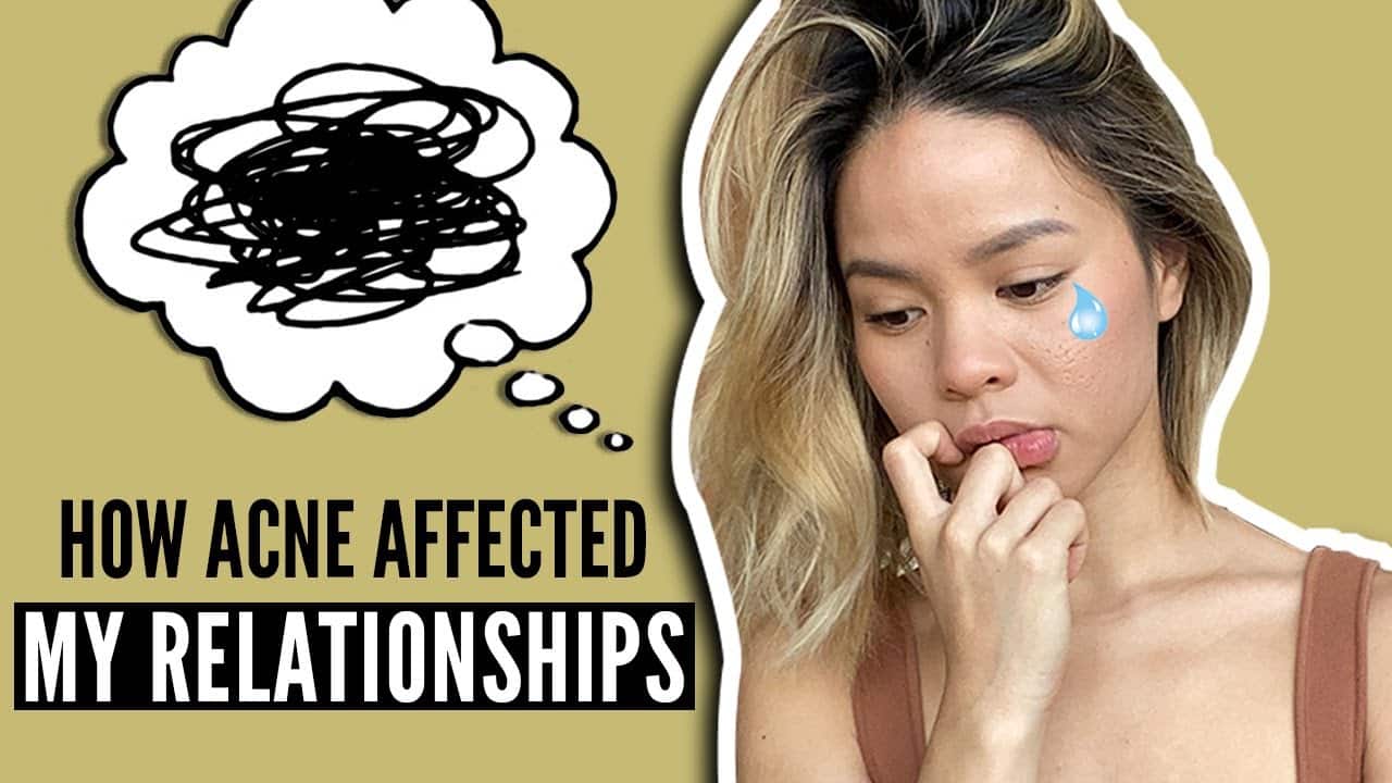 Acne Scars and How They Affect Relationships (3 Tips That Can SAVE Yours!)