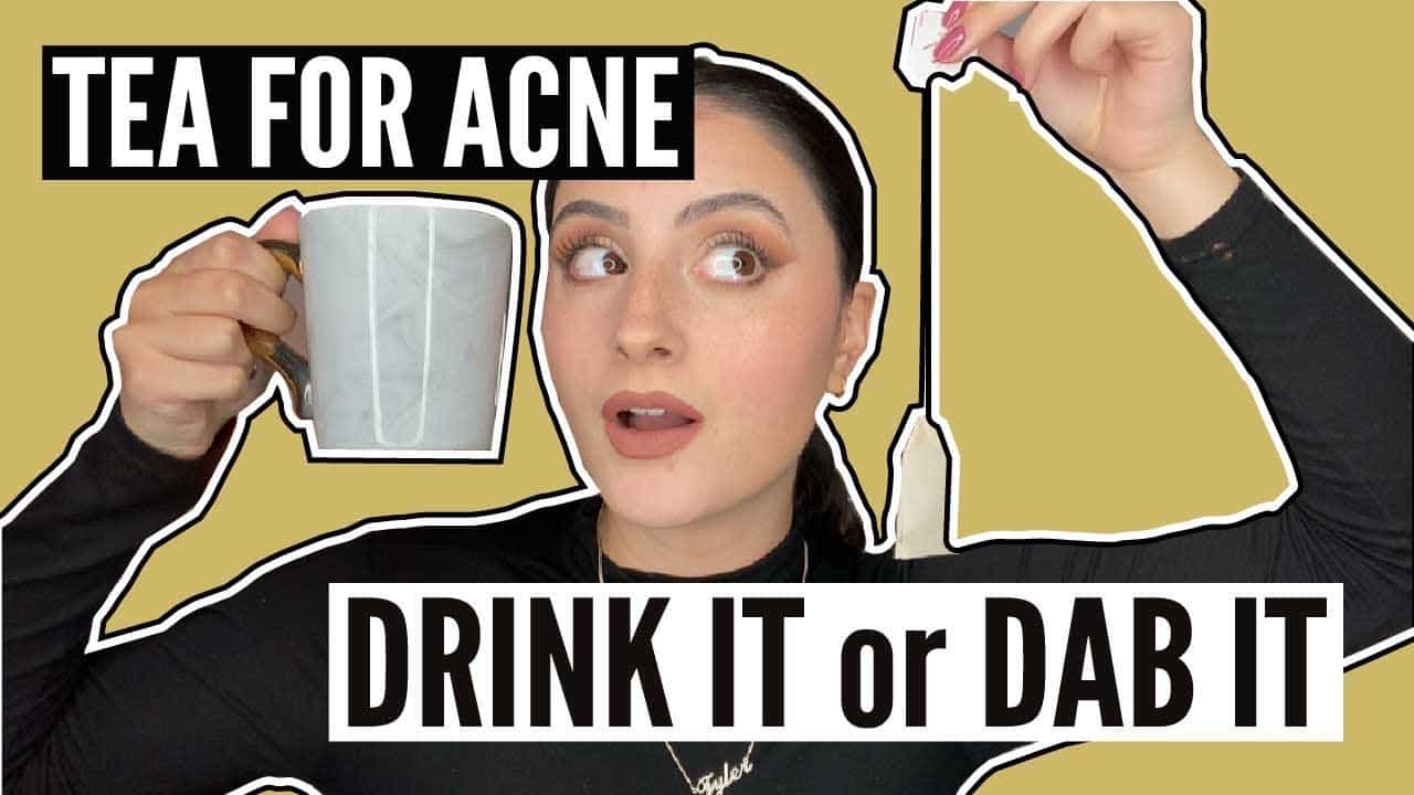 Acne Treatment – How to Use the Best Teas to Dramatically Help Your Skin