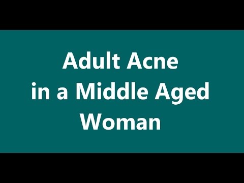Adult Acne in a Middle Aged Woman – Part I