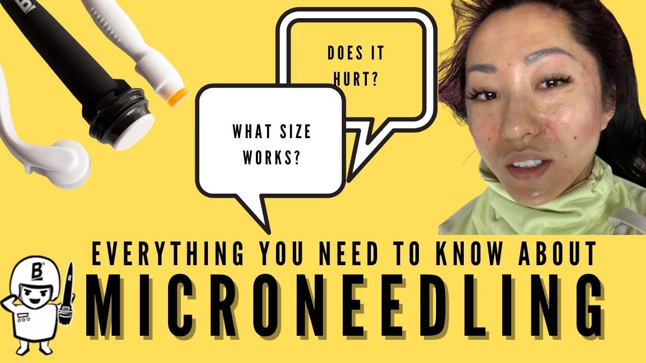 ALL ABOUT MICRONEEDLING (pain, size, benefits, at home)