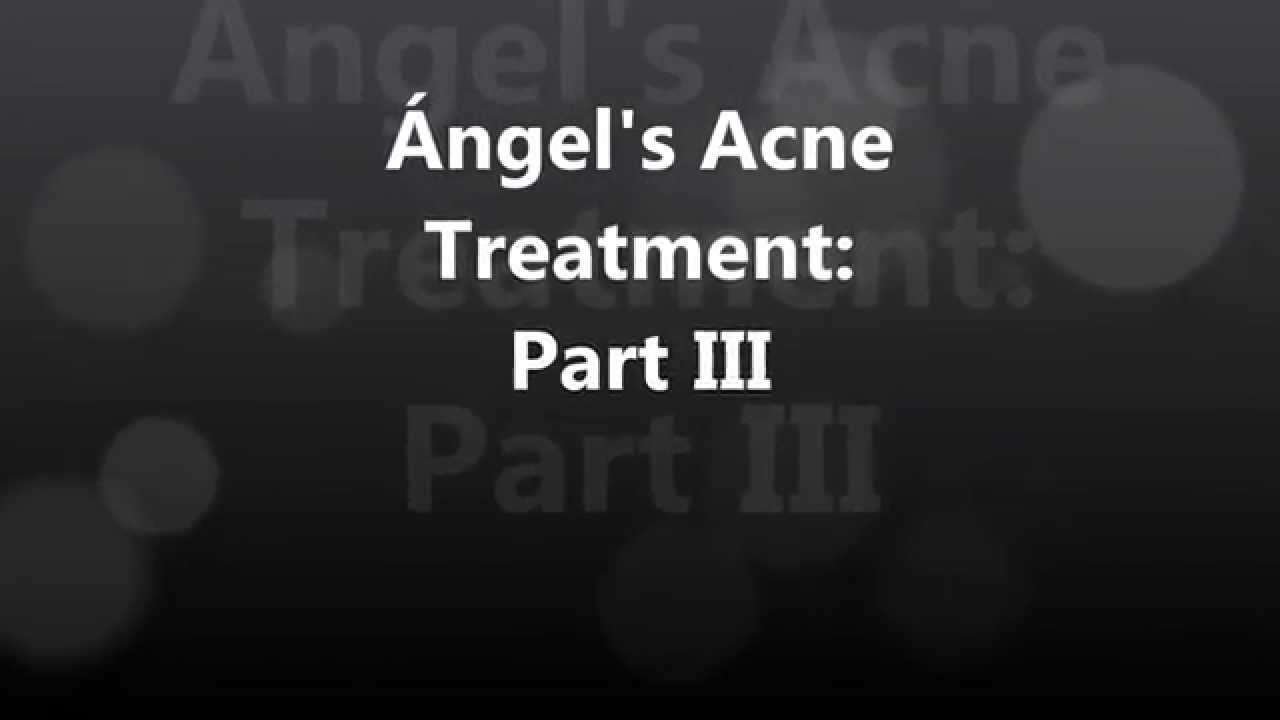 Ángel’s Acne Treatment: #3