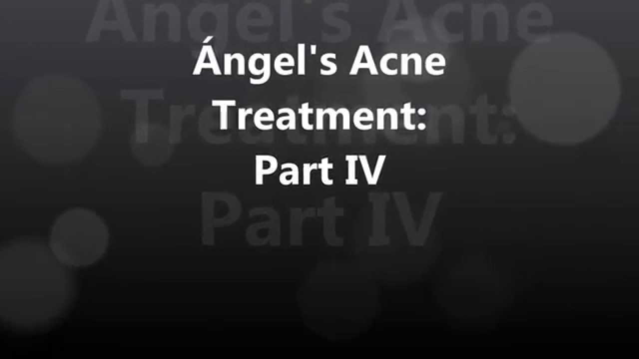 Ángel’s Acne Treatment: #4