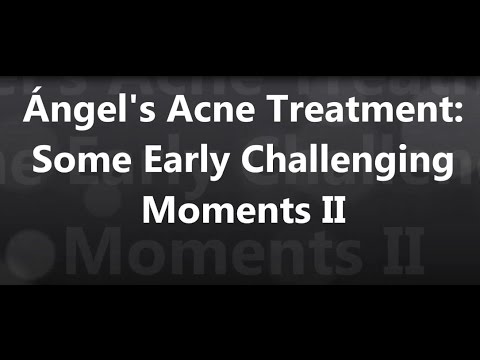 Angel’s Acne Treatment – Some Early Challenging Moments – Session 4