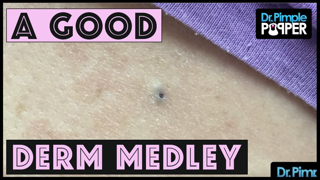 Another Derm Medley for you Popaholics!