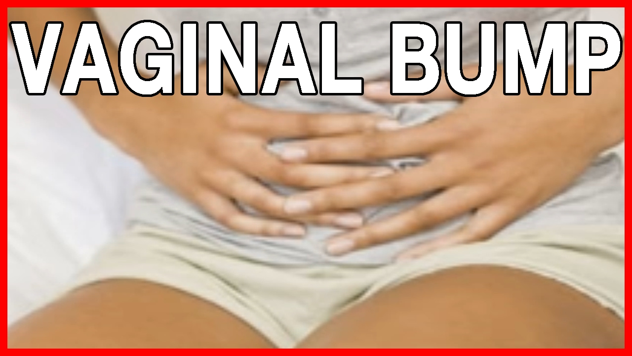 Bartholins cyst or vaginal bumps causes and treatment