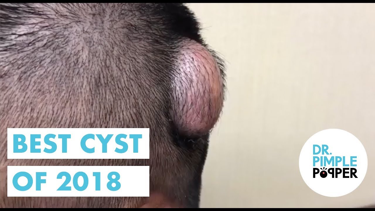 Best of Cysts Part One, 2018