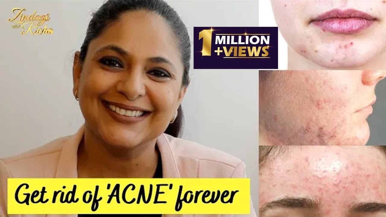 Best Remedies for Acne in 5 Minutes ! #Zindagi_With_Richa