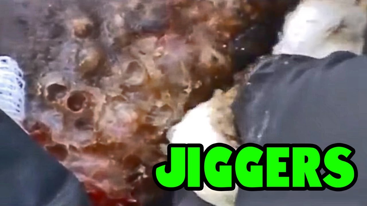 Better than Pimple Popping!  Jigger Symphony 2017