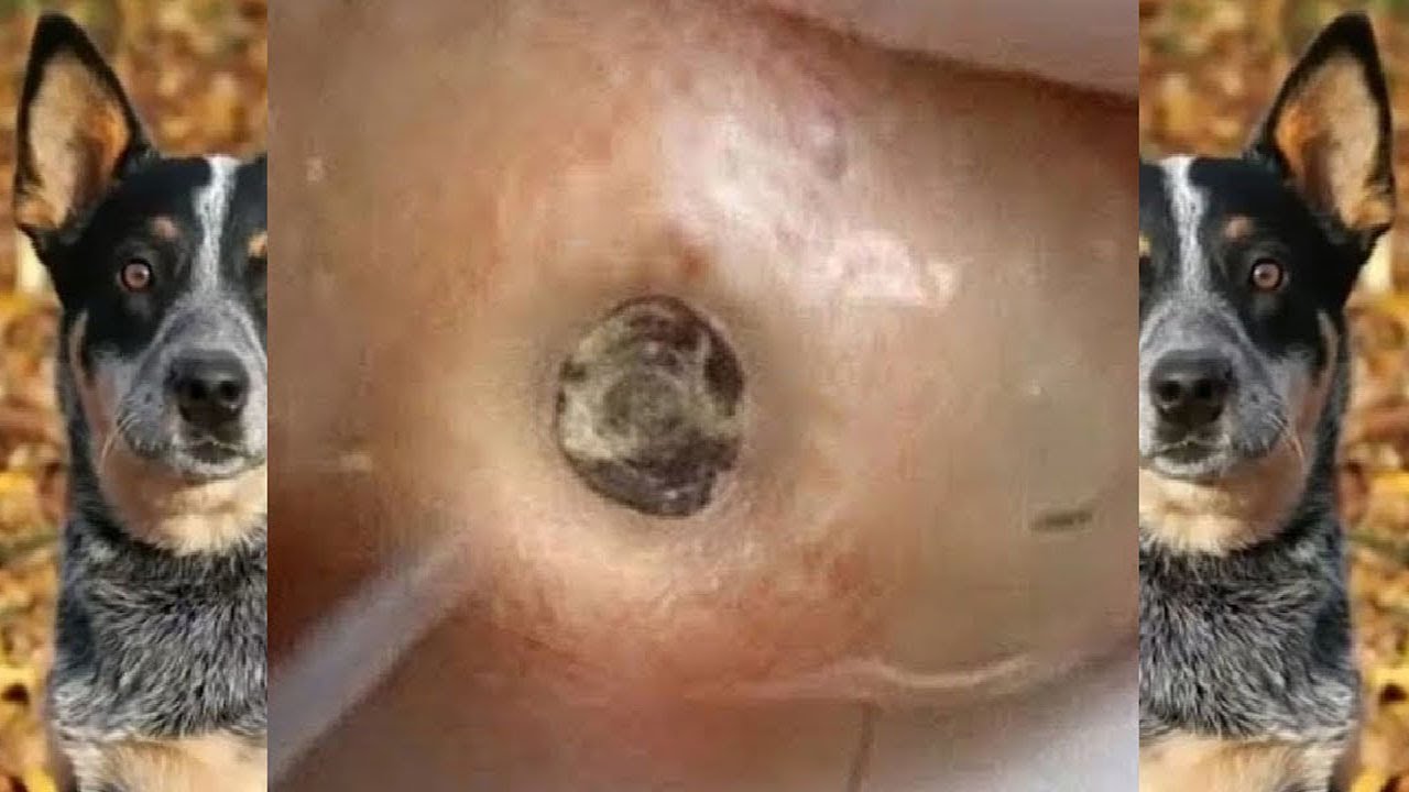 Big Cystic Acne Blackheads Extraction Blackheads & Removal Pimple Popping #MD163