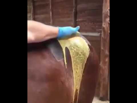 biggest pimple squirt horse ; popping a huge pimple