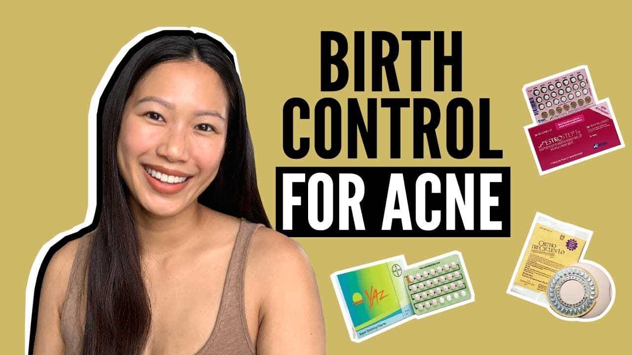 Birth Control Pills: How They Affect Acne (Watch This If You’re Taking Them)