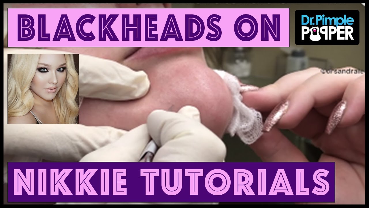 Blackhead Extractions: NikkieTutorials & Dr Pimple Popper!