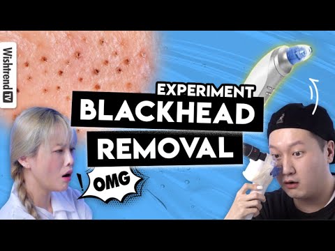 Blackhead Removal Test: Vaccum Suction vs Cleansing Oil, Which One is better?