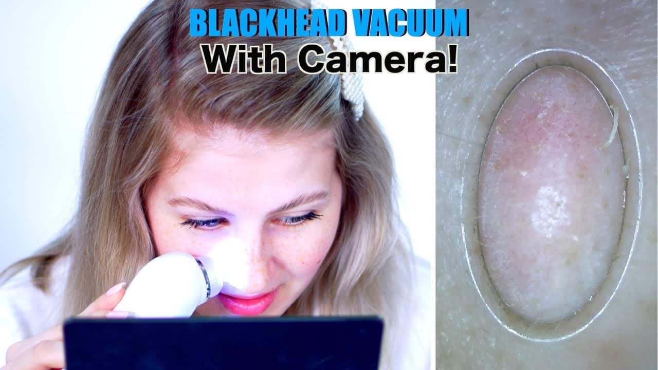 BLACKHEAD Removal Vacuum with CAMERA!