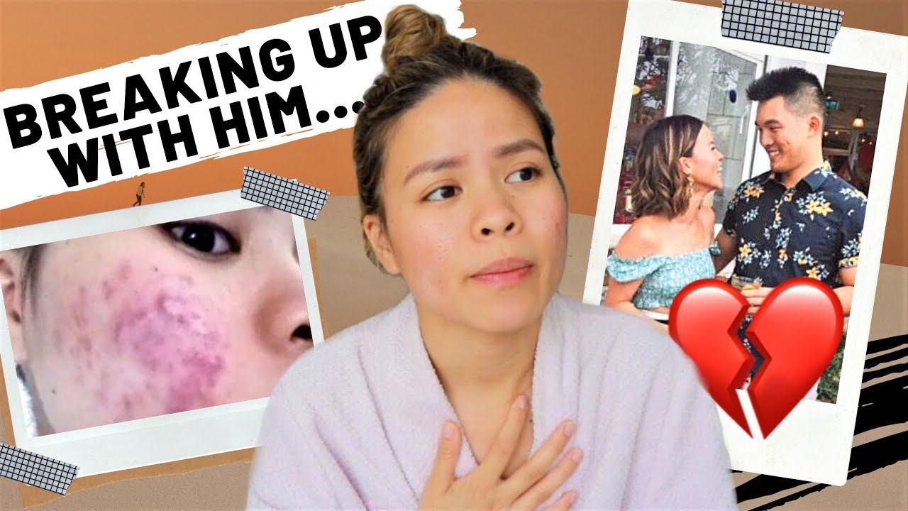 Breaking Up With Him Cause of My Acne…