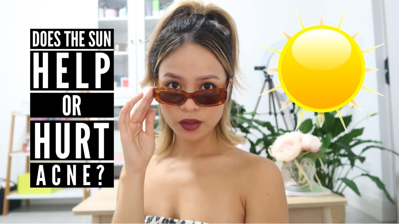 Can the Sun Really Cure Acne?