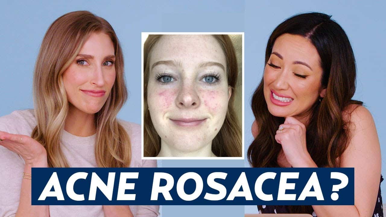 Can You Have Acne AND Rosacea? Dermatologist Reacts to Dana's Skincare Routine | DERM REACTS