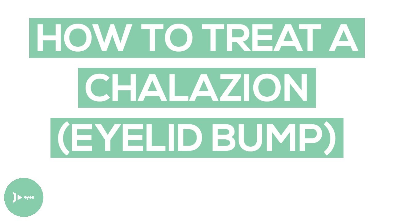 Chalazion (Eyelid Bump) Treatment | Exactly How To Treat a Chalazion | IntroWellness