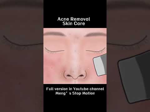Clean whiteheads, blackheads, and acne.#shorts #asmr #animation
