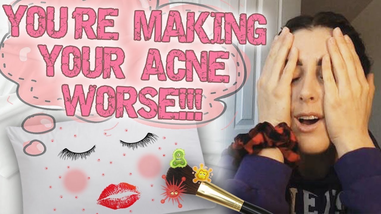 Common Mistakes Making Your Acne Worse (Banish Kit Giveaway)
