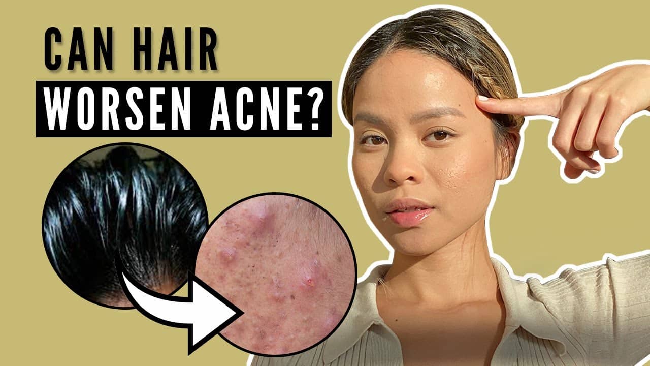 Correlation Between Hair and Acne