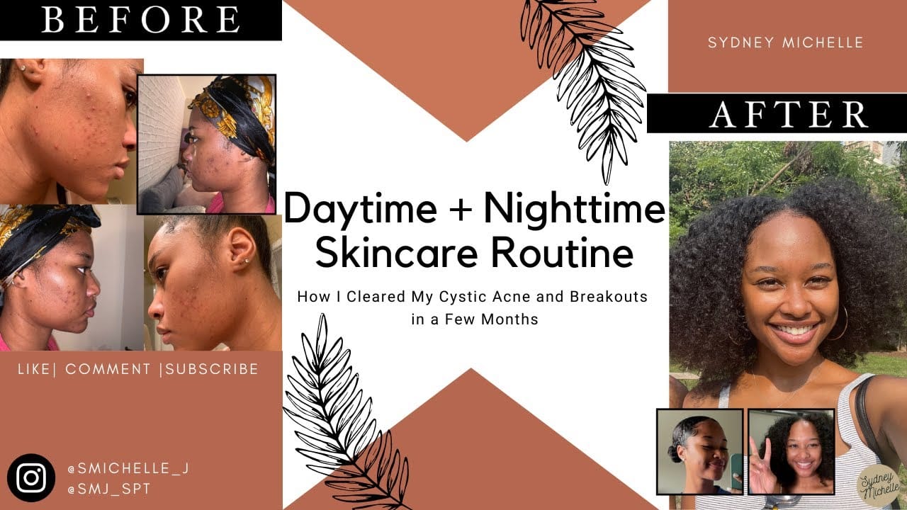 DAYTIME + NIGHTTIME SKINCARE ROUTINE || HOW I CLEARED MY CYSTIC ACNE