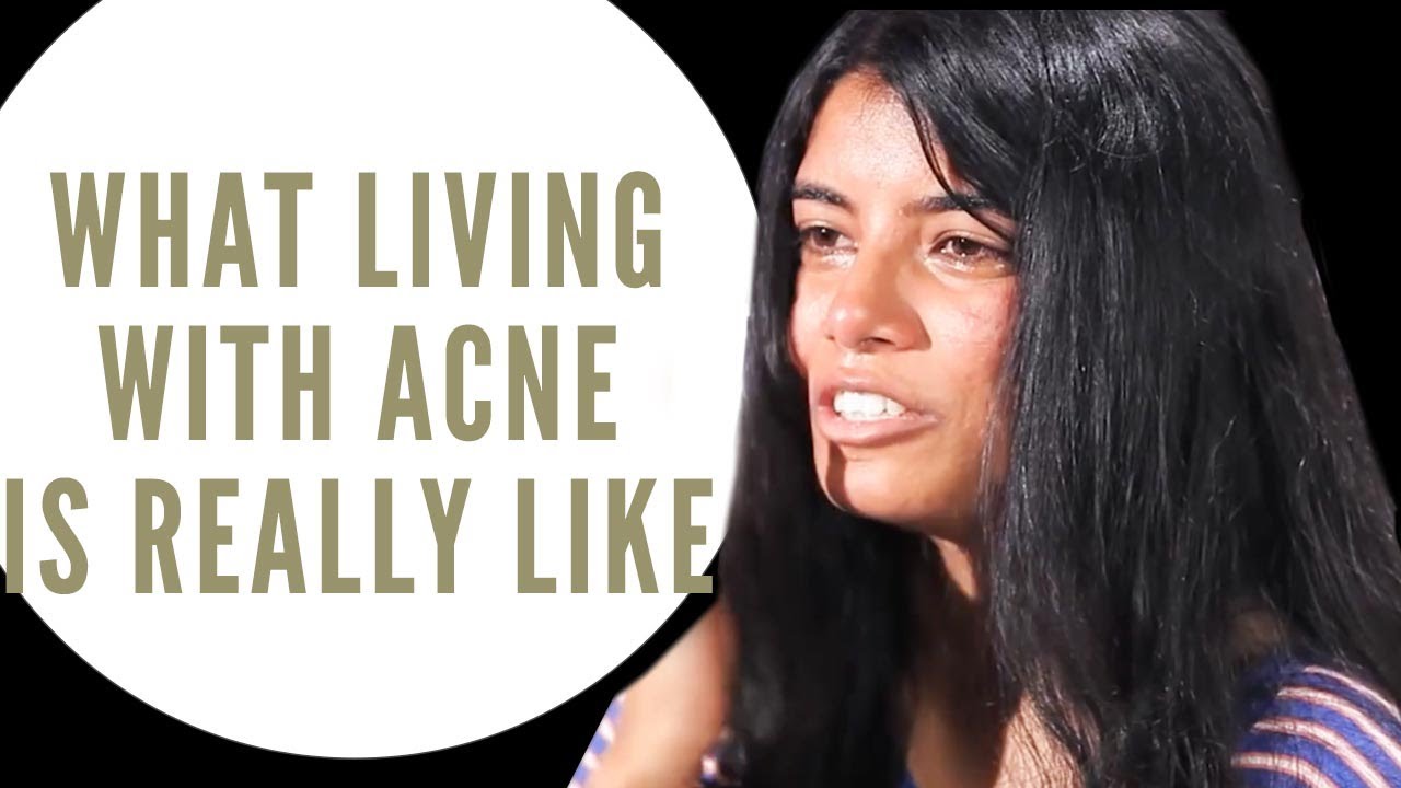 Dealing With A Face Full Of Cysts | Banish Acne Diaries Trailer