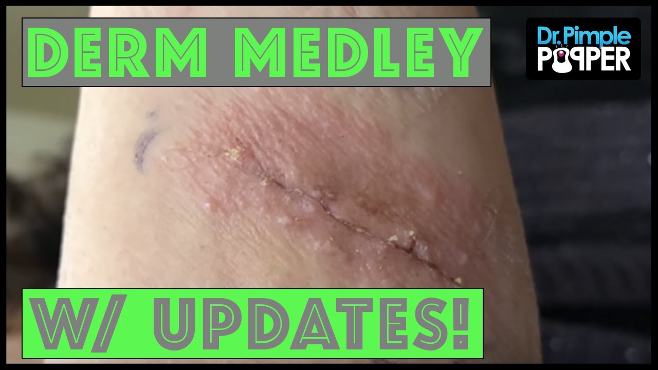 Derm Medley with Updates: DerMedUpdates