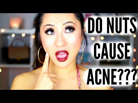 DO NUTS CAUSE ACNE???