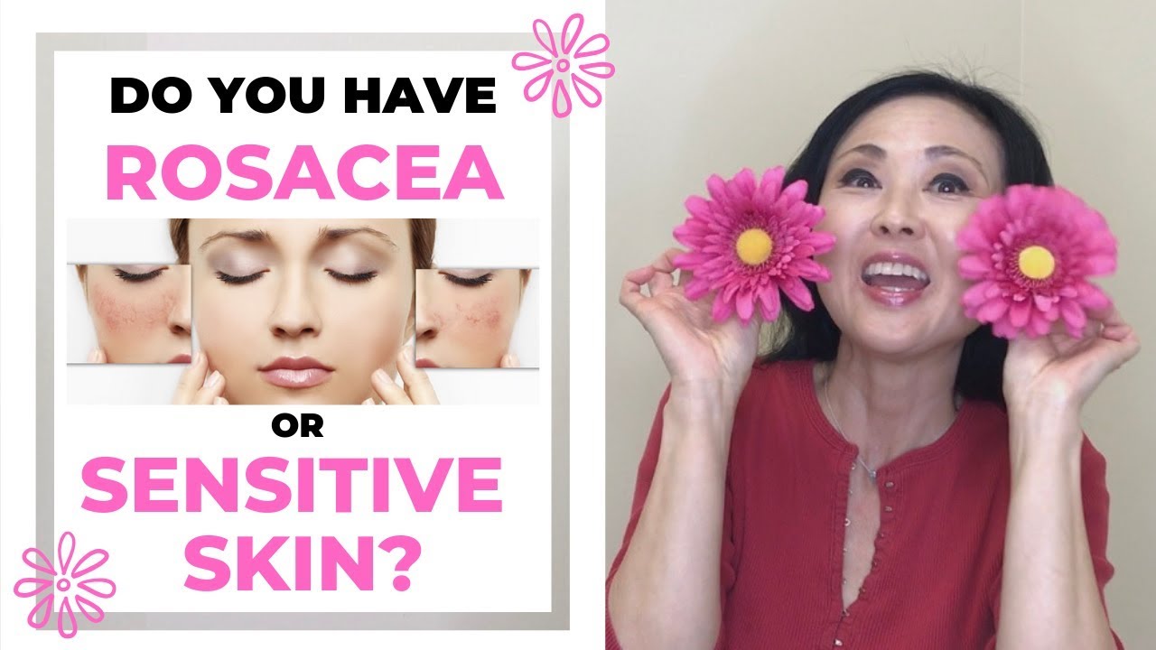 Do you have Rosacea vs Sensitive Skin?  (Rosacea Treatments) Signs of Rosacea