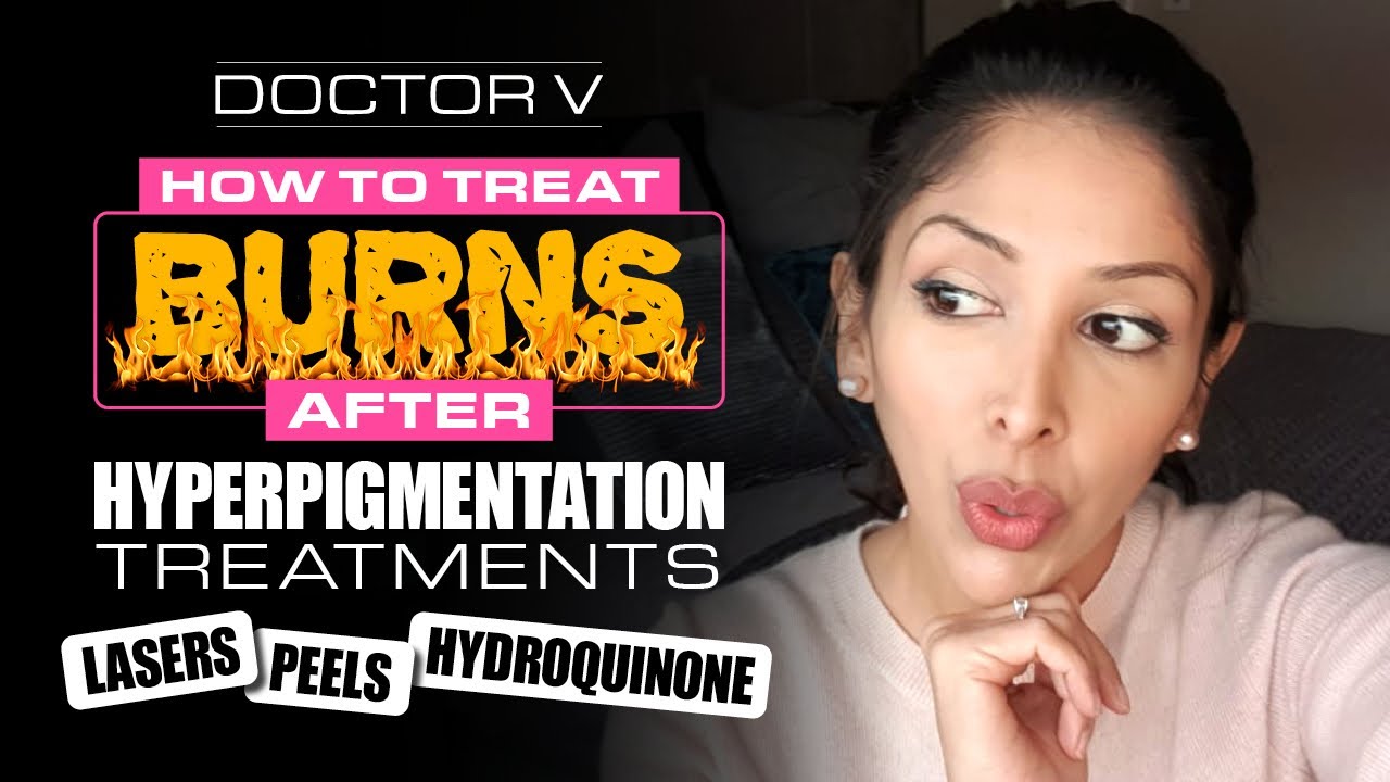 Doctor V – How To Treat Burns after Hyperpigmentation Treatments | Skin of Colour |