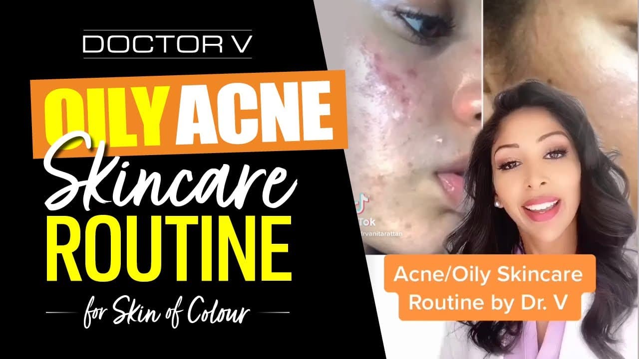 Doctor V – Oily, Acne Skincare Routine For Skin of Colour | Brown Or Black Skin | #shorts