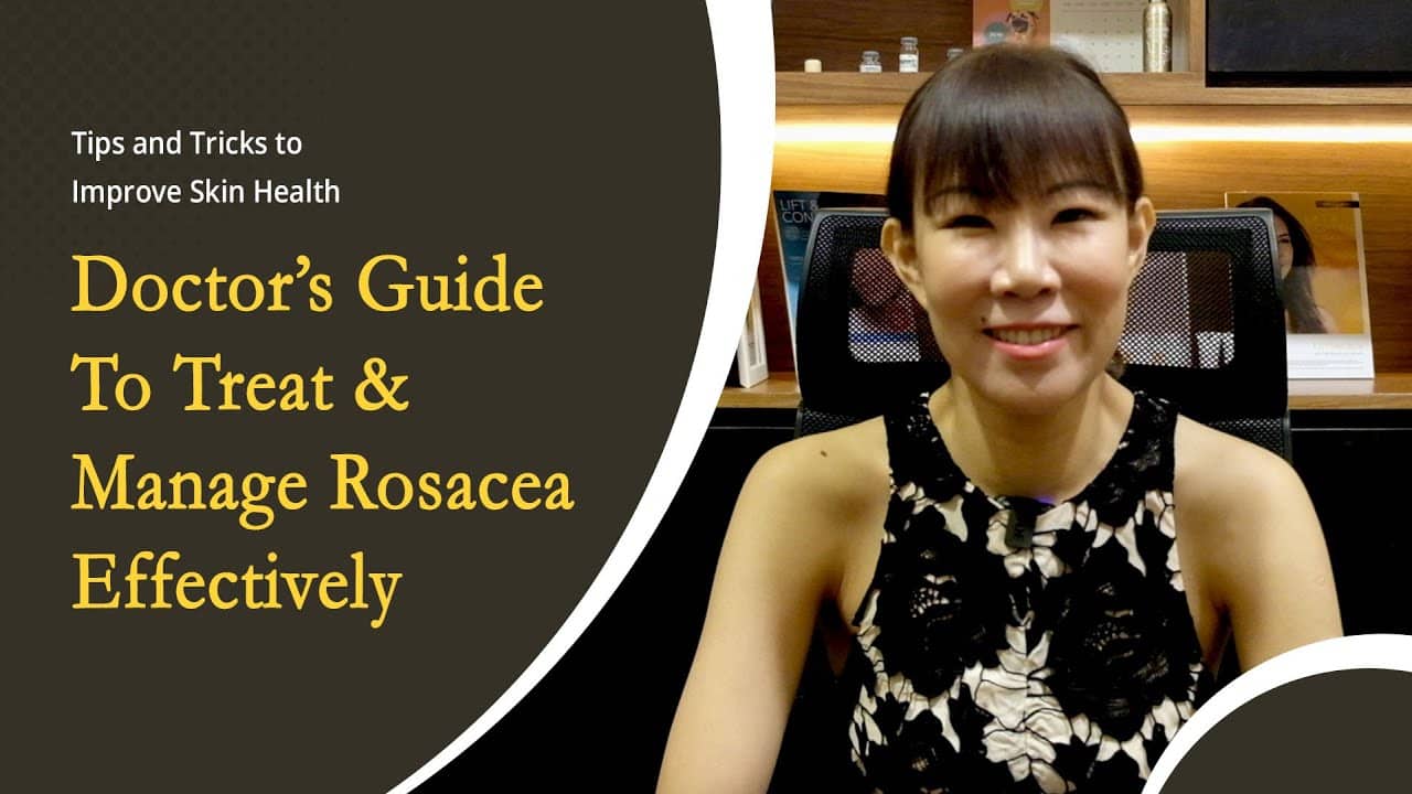 Doctor's Guide to Treat and Manage Rosacea Effectively
