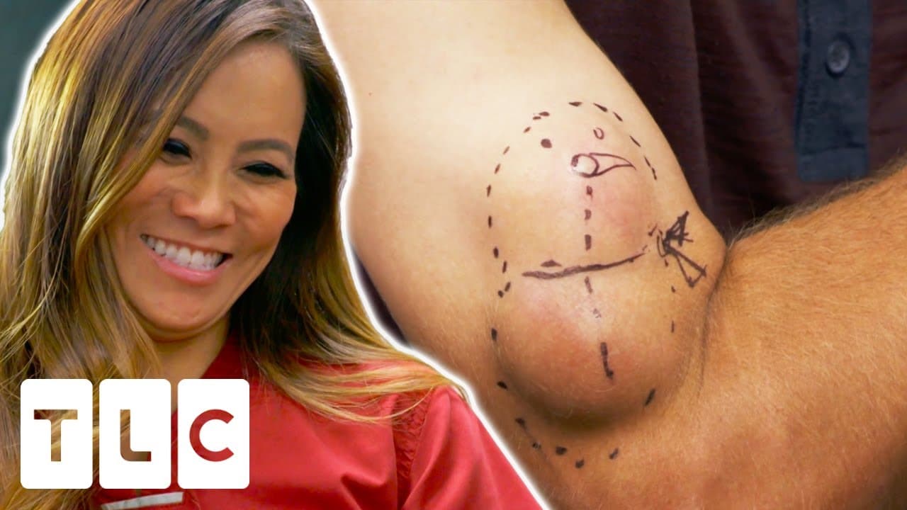 Dr. Lee Pops A Snowman-Shaped Cyst On A Man's Arm | Dr. Pimple Popper: 12 Pops Of Christmas